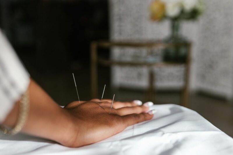 Acupuncture vs. Acupressure: What's the Difference? | Acupuncture Atelier