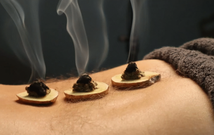 Moxibustion treatment for chronic pain relief at Acupuncture Atelier in Hoboken—book your natural pain care session today!