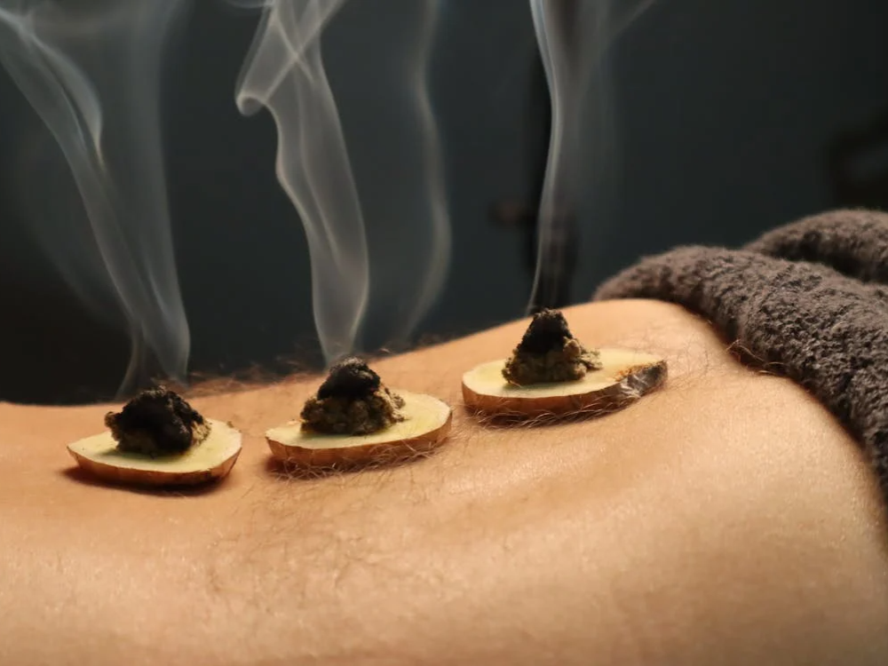 Moxibustion treatment for chronic pain relief at Acupuncture Atelier in Hoboken—book your natural pain care session today!